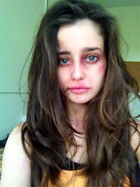 holly earl on twitter you should see the other guy