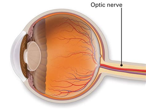 cataract surgery  kochi anatomy   eye optic nerve