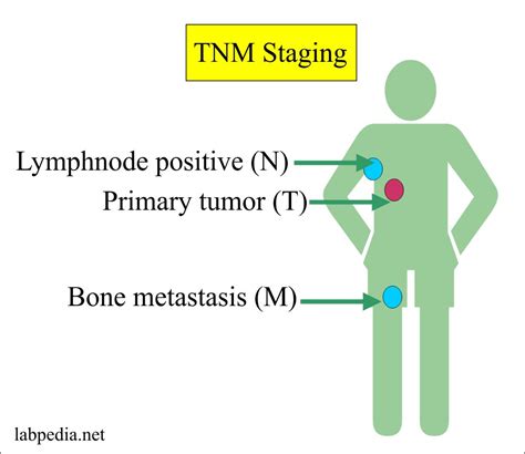 Tumor Marker Part 1 Definition Of Tumor Markers Staging And Free