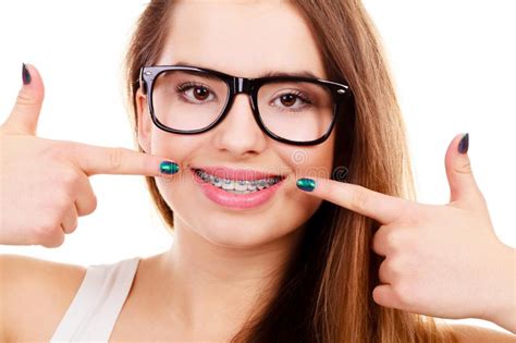 Nerdy Woman Showing Her Teeth With Braces Stock Image Image Of Face