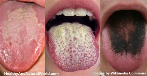 8 warning signs your tongue may be sending