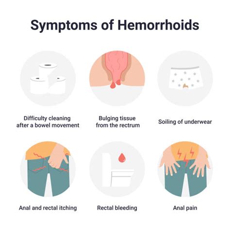 clip art of hemorrhoids illustrations royalty free vector graphics