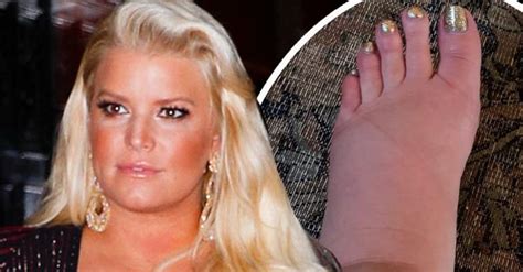 Jessica Simpson Suffers From Bloated Foot As She Awaits Arrival Of