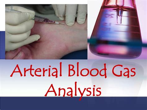 arterial blood gas analysis powerpoint
