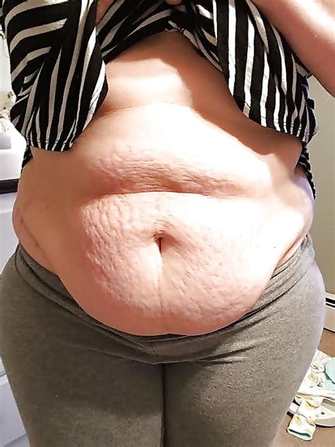 bbw sluts with sexy stretch marks on belly 68 pics