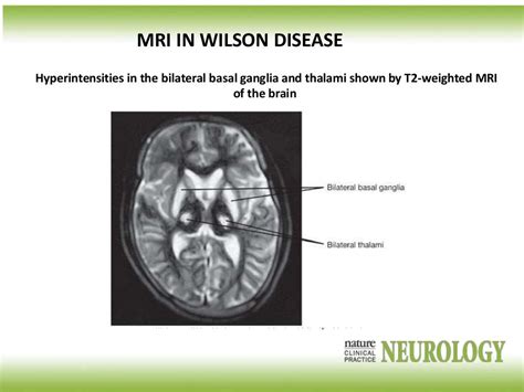 wilson radiology