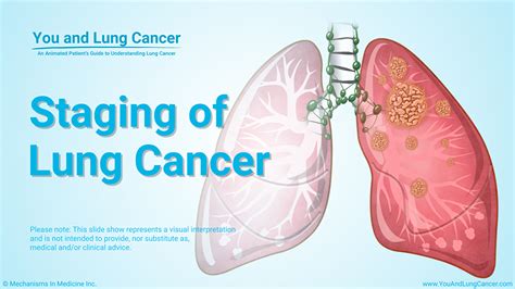 how is non small cell lung cancer nsclc diagnosed