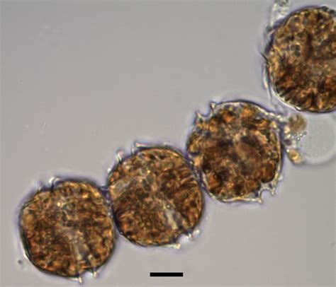 descripcion general alexandrium catenella alexandriumcatenella