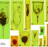 Afbeeldingsresultaten voor "cymatocylis Cristallina". Grootte: 189 x 185. Bron: www.researchgate.net