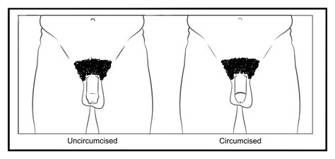 circumcision gdhr portal