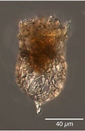 Afbeeldingsresultaten voor "tintinnopsis Fimbriata". Grootte: 120 x 185. Bron: www.marinespecies.org