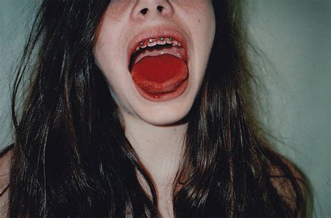 Fuck Yeah Girls With Braces