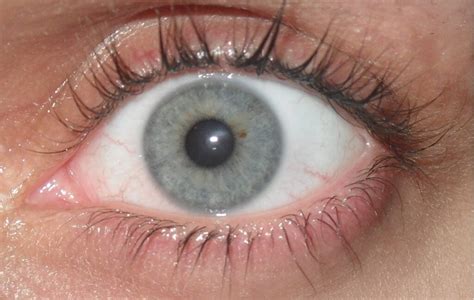 gray eyes pictures genetics facts