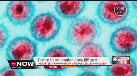 florida hiv cases on the rise youtube