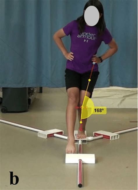knee valgus angle   frontal plane   point  maximal
