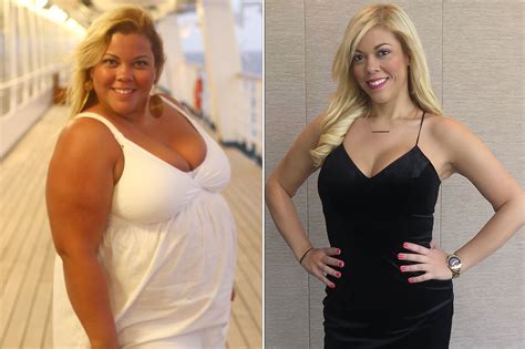 Woman Who Dropped 120 Lbs After Gastric Bypass Surgery