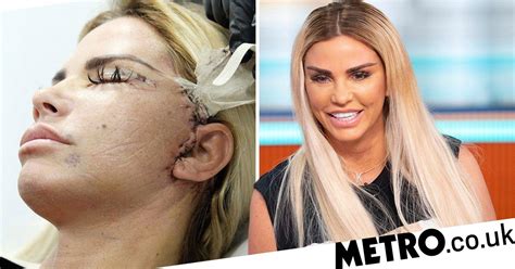 katie price left terrified her ears might fall off after face lift