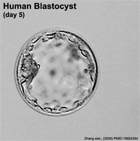 filehuman embryo day  labelgif embryology