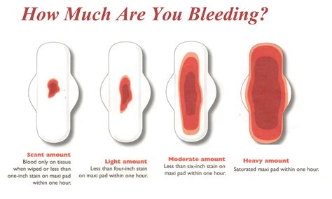 abnormal bleeding vagina after menopause naked photo
