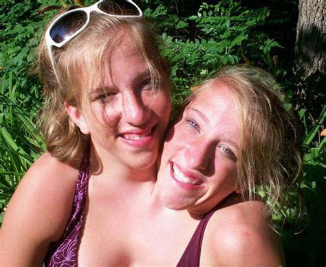 Abby And Brittany Hensel Identical Conjoined Twins