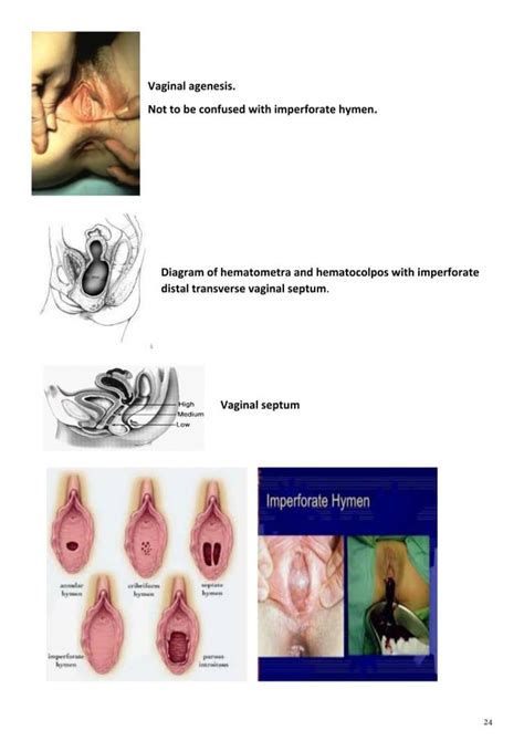 Gynecology