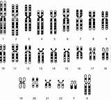 Karyotype Haploid Chromosome Diagrammatical Banding Bands sketch template
