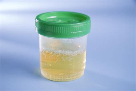 foamy urine  health hearty