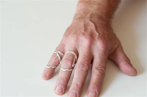 we design finger splints