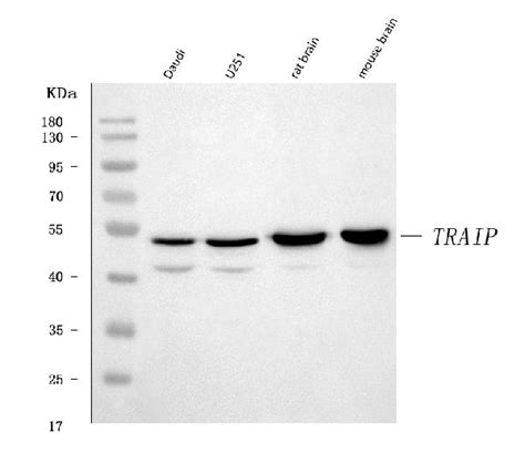 triptraip antibody