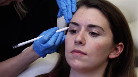 4 things to expect for first time botox injections your