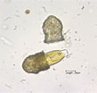 Image result for "codonella Galea". Size: 109 x 104. Source: microfloraenfauna.com