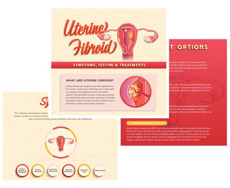 Uterine Fibroid Treatment Ivc