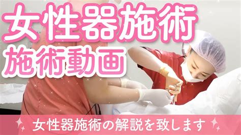 【小陰唇縮小術】施術動画大公開！女性器のお悩み解消！デリケートゾーンの施術！【vio】 Youtube