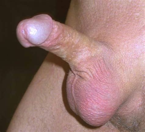 small erect penis