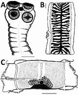 Taenia Tapeworm Saginata Drawing Scolex Northern Tapeworms Mature Jpeg Cdc Drawings Paintingvalley Figure Russia sketch template