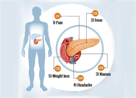 6 Important Signs Of Pancreas Problems — Step To Health