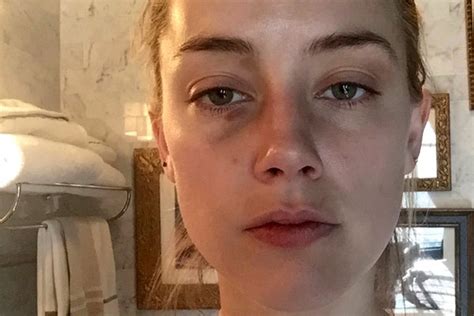 more photos of amber heard s bruised face released page six