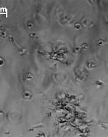 Image result for chondrocyt. Size: 157 x 195. Source: www.presens.de