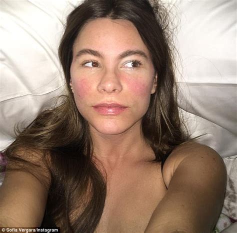 sofia vergara shows colorful cheeks after 102 fever daily mail online