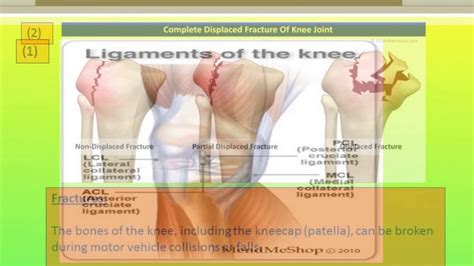 treatment knee pain  ipoh youtube