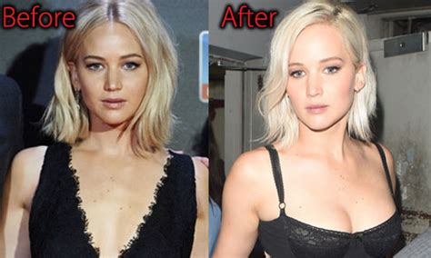 jennifer lawrence plastic surgery before and after nose job pictures