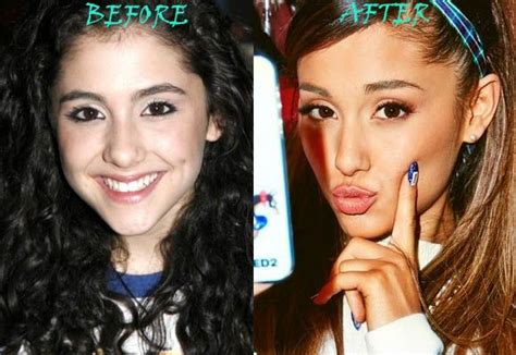 ariana grande plastic surgery before and after nose job celebrity