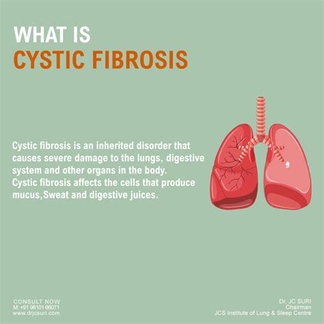 cystic fibrosis cf symptoms causes diagnosis and treatment dr j c