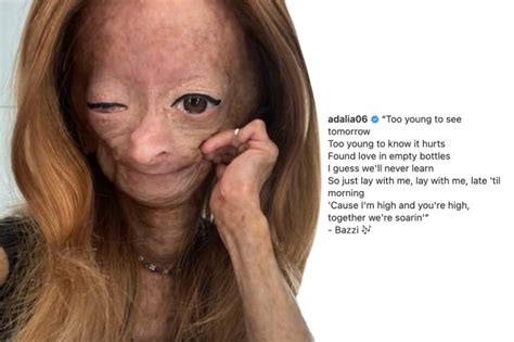 Adalia Rose Williams Wrote About Being Too Young To See Tomorrow