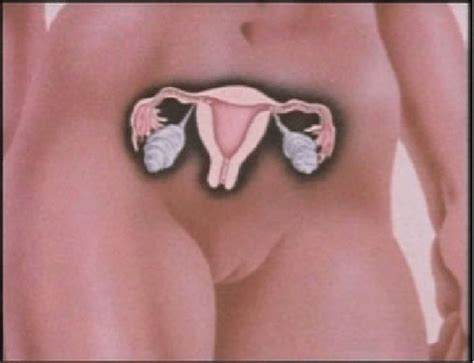 Diagram Of The Female Reproductive System From To Mrs