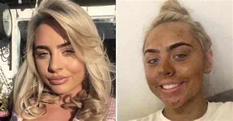 Teenager Left Looking Like A Dorito After Her First Attempt At Using