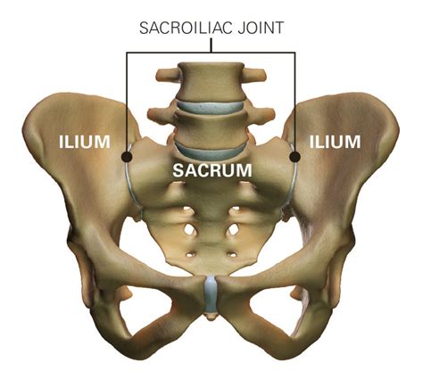 difference  sacroiliac joint dysfunction  sciatica mypainca