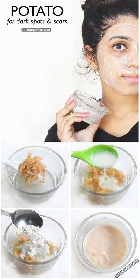 potato for dark spots and acne scars beauty pinterest piel faciales and maquillaje