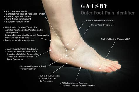 foot pain chart   depth guide  identifying foot pain gatsbyshoes