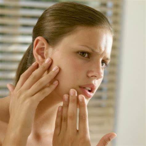 female corners pimples  acne enemy   beauty